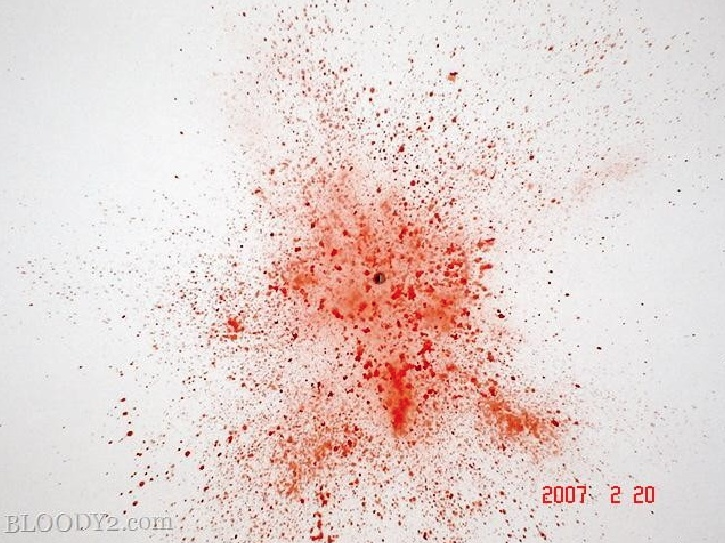 gun shot spray blood spatter forensics